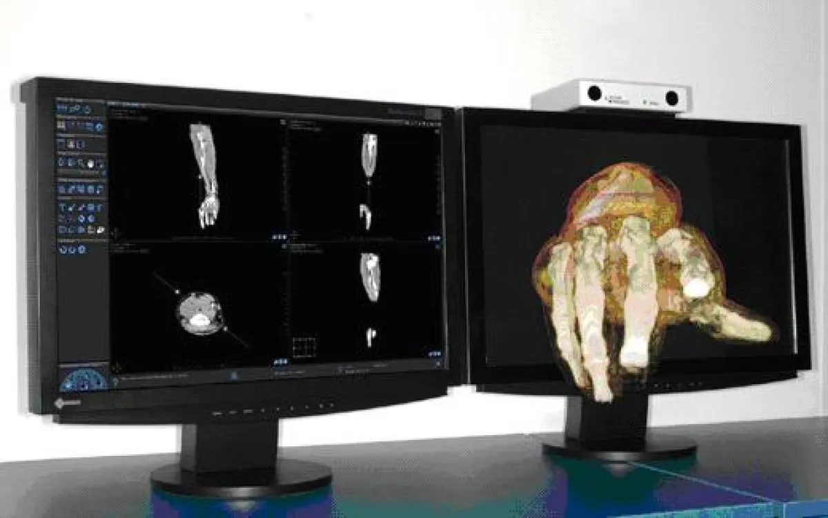 SVI 3D Medical Workstation