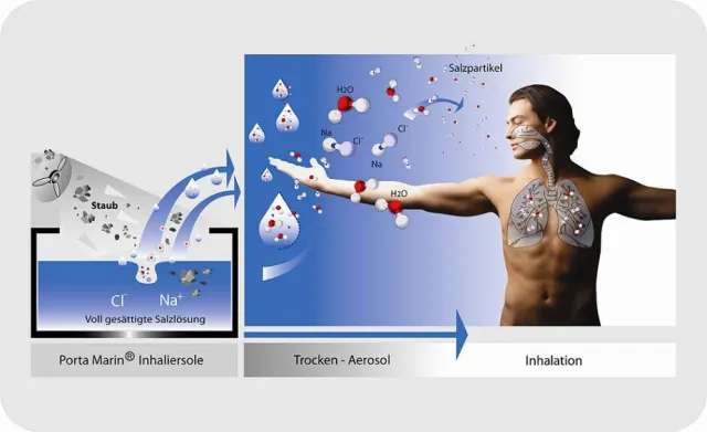 Bild: Von wegen Salz trocknet aus: Gesundheitsfördernde Wirkung von Inhalier-Sole unumstritten