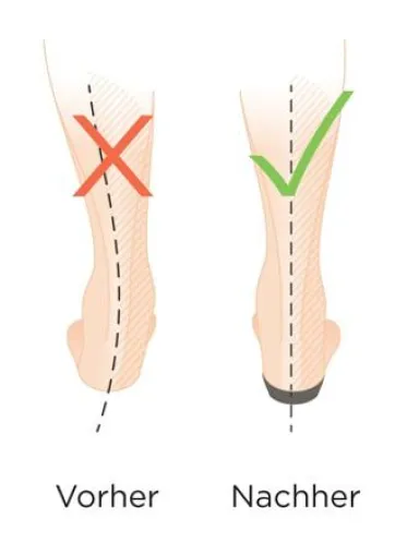 Bild: Flipflops und Sandalen von VIONIC: Orthopädische Schuhe sorgen für optimales Wohlbefinden