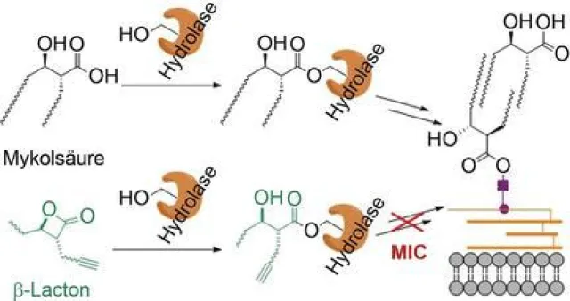 Undercover im Kampf gegen Tuberkulose Bild: Undercover im Kampf gegen Tuberkulose