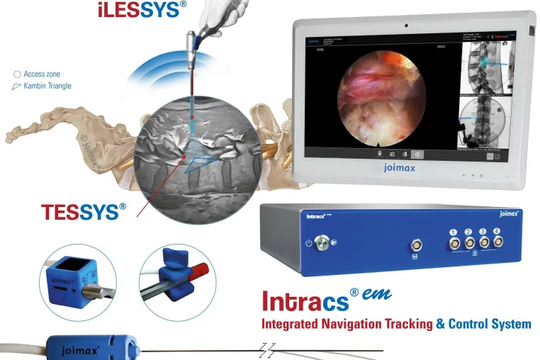 Bild: joimax® präsentiert Navigationssystem Intracs® em beim GSC und der DGNC; Start klinischer Erprobungen