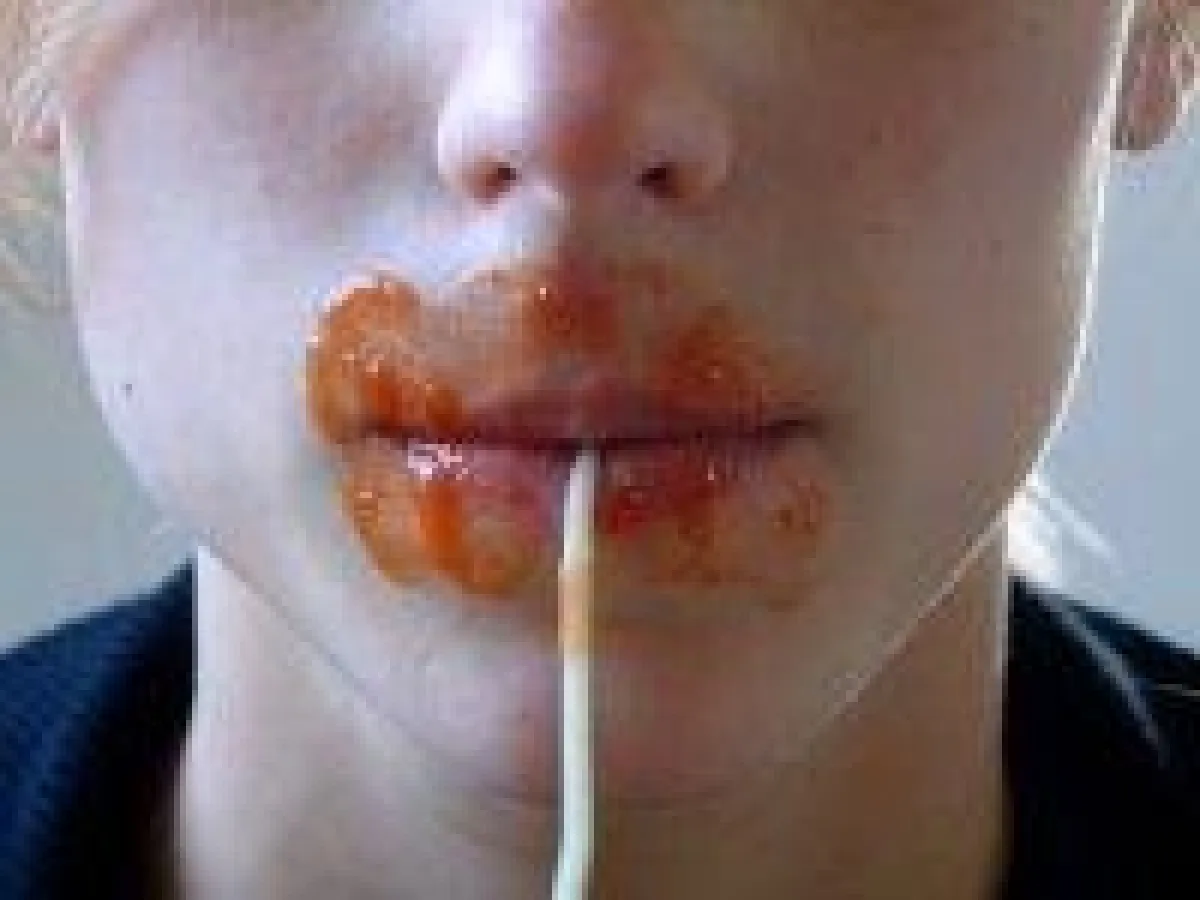 Neue Therapieansätze im Kampf gegen Bulimie