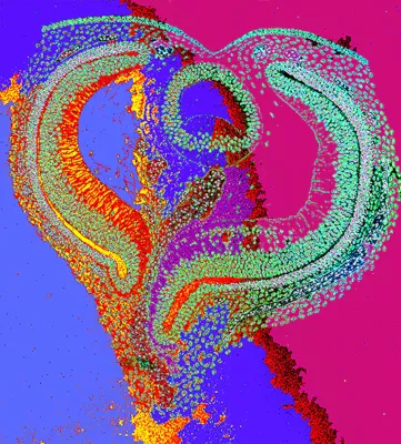 Bild: L.O.V.E. - anlässlich des Internationalen Frauentags