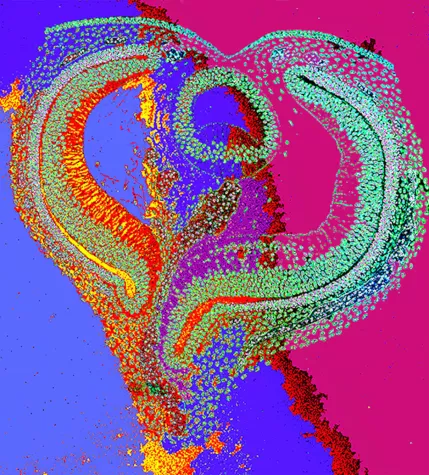 Bild: L.O.V.E. - anlässlich des Internationalen Frauentags