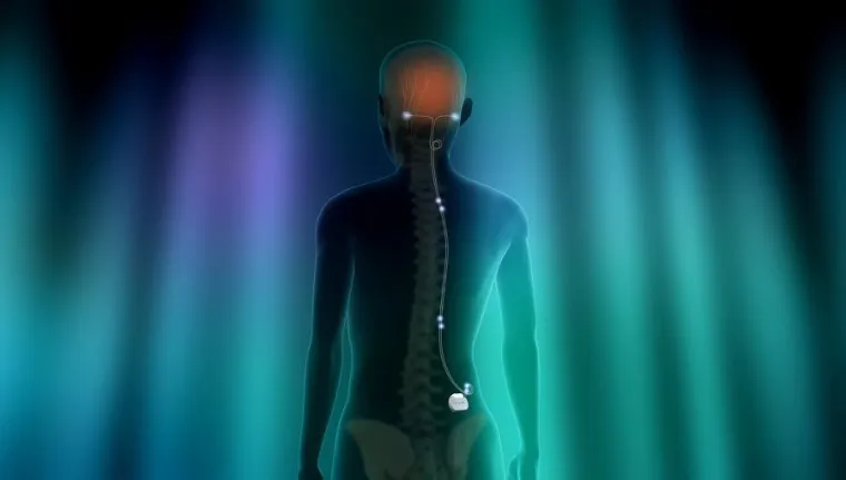 Kopf außer Kontrolle - Mit der richtigen Migränetherapie zu neuer Lebensqualität Bild: Kopf außer Kontrolle - Mit der richtigen Migränetherapie zu neuer Lebensqualität