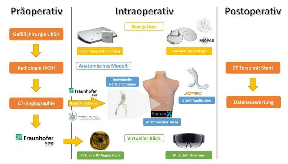 Zusammenspiel der vier Kernkomponenten des Systems am Beispiel der Hauptschlagader (Aorta) (Abb.: Nav EVAR)