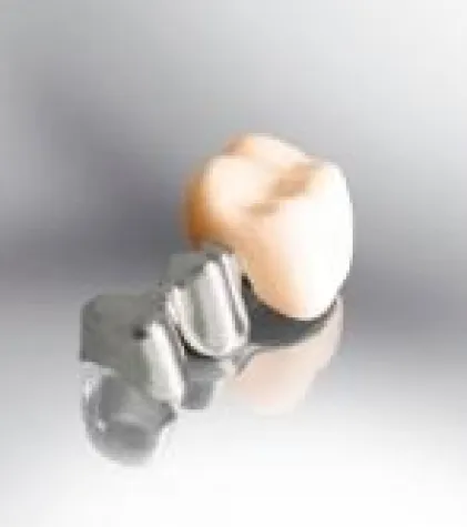 Bild: Altbewährtes mit neuem Kern – Infix-Technologie jetzt auch auf Metallbasis