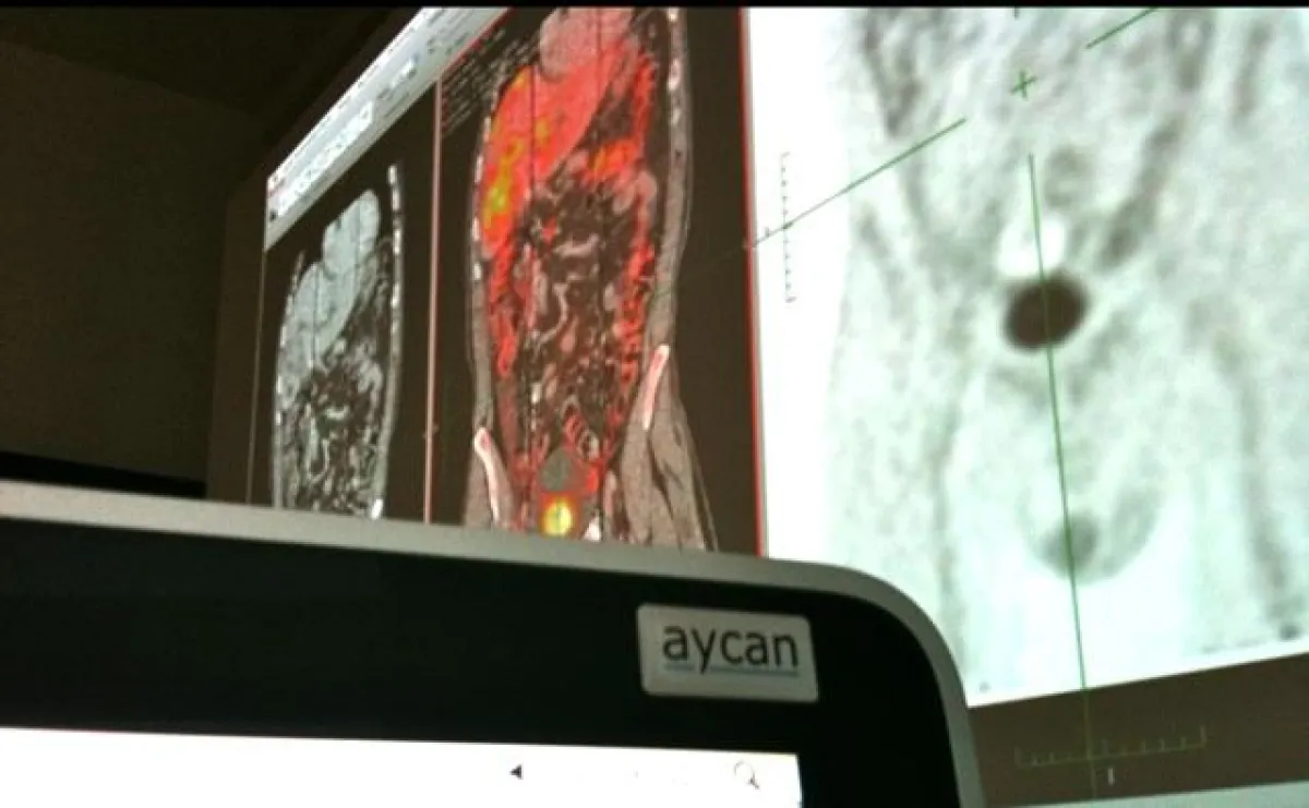 Fusioniertes PET-CT mit OsiriX PRO