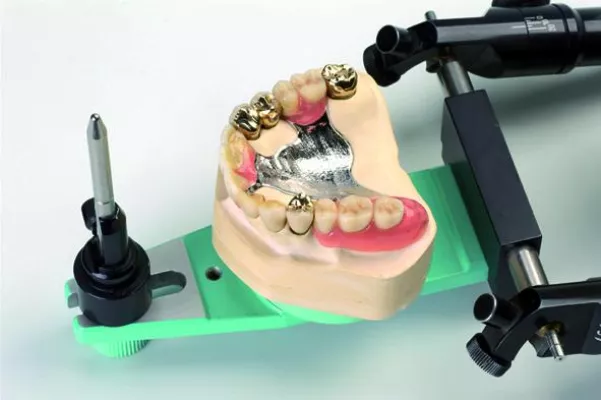 Günstiger Zahnersatz - was kostet eigentlich eine Krone? Wissenswertes zum Thema Bild: Günstiger Zahnersatz - was kostet eigentlich eine Krone? Wissenswertes zum Thema