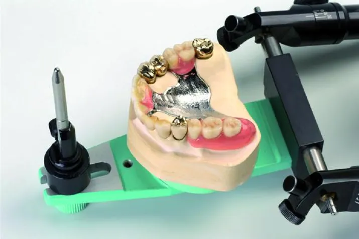 Bild: Günstiger Zahnersatz - was kostet eigentlich eine Krone? Wissenswertes zum Thema