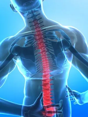 Bild: Wirbelsäule aus dem Lot - Hilfe zur Selbsthilfe