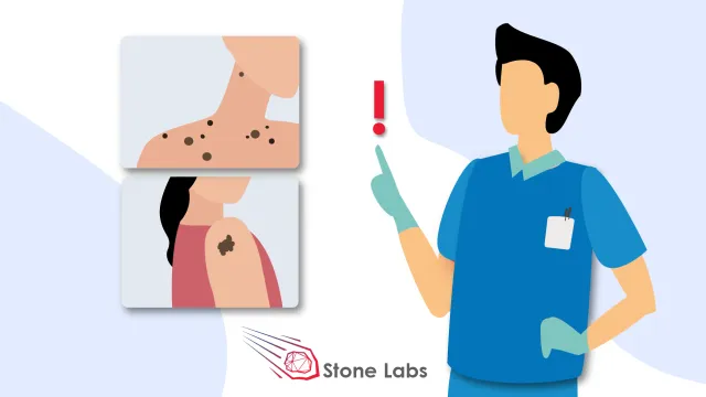 Startup-Ideen: Website der Hautkrebs-Spezialisten Bild: Startup-Ideen: Website der Hautkrebs-Spezialisten