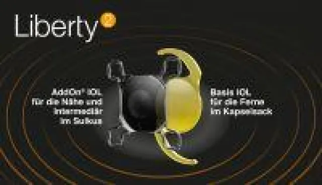 Bild: Eine Hintertür für die multifokale Linse?!!