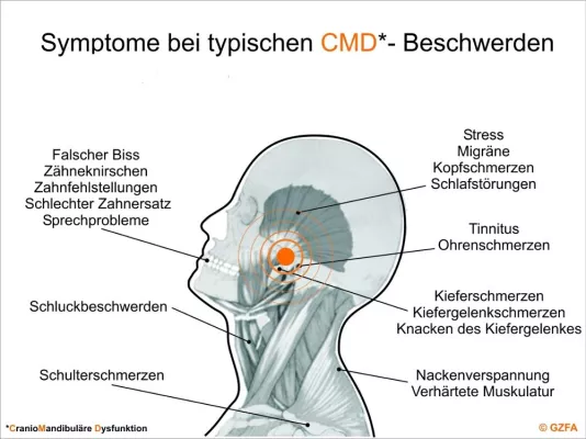 Bild: Mehr Klarheit über Rückenschmerz - GZFA über die fachübergreifende Therapie mit dem Zahnarzt