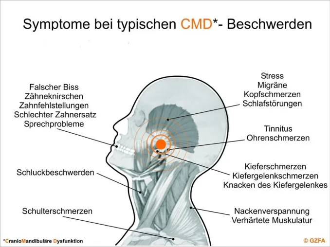 Bild: Mehr Klarheit über Rückenschmerz - GZFA über die fachübergreifende Therapie mit dem Zahnarzt