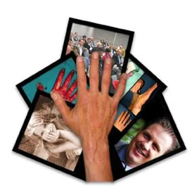 Jahresergebnisse zum Einsatz der Kollagen-Elastin-Matrix in der Wiederherstellungschirurgie Bild: Jahresergebnisse zum Einsatz der Kollagen-Elastin-Matrix in der Wiederherstellungschirurgie