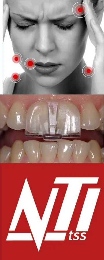 NTI-tss lindert CMD Beschwerden