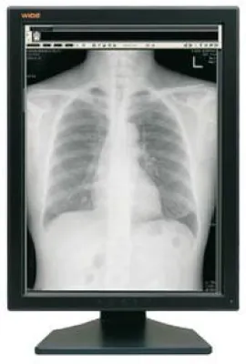 Bild: Hochleistungsmonitore für die medizinische Bildverarbeitung und Befundung