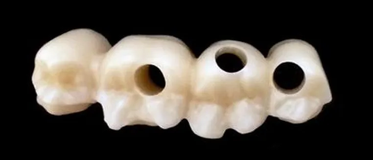 CADfirst Dental Fräszentrum stellt neue Preise für Zirkonoxid Premium- und Economy-Line Bild: CADfirst Dental Fräszentrum stellt neue Preise für Zirkonoxid Premium- und Economy-Line