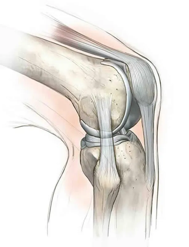 Arthroseansatz Knie