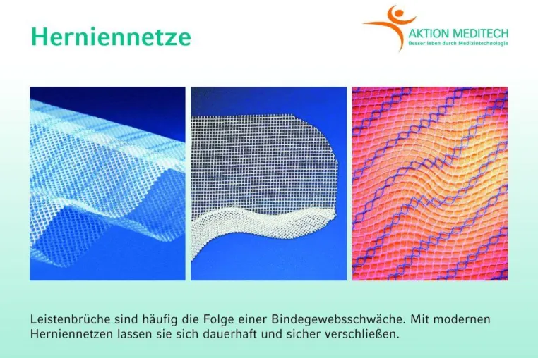 Verstärkung für schwaches Bindegewebe Bild: Verstärkung für schwaches Bindegewebe