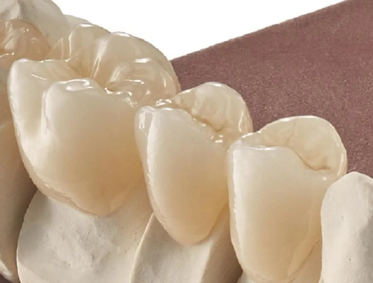 Das Multilayerzirkon M-ZR multilayer HT verfügt über eine sehr hohe Transluzenz bis zu 42 %.