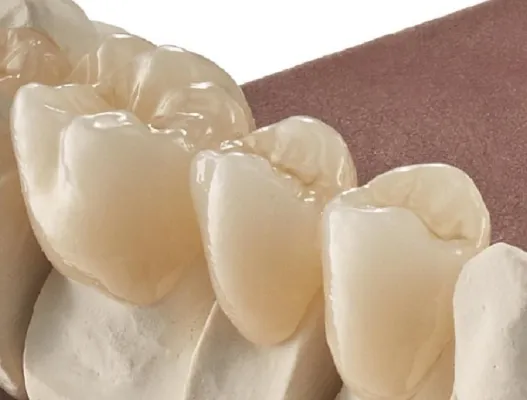 M-ZR Zirkon Discs - Digital Solution by Merz Dental Bild: M-ZR Zirkon Discs - Digital Solution by Merz Dental