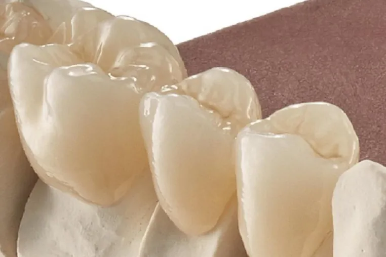 Bild: M-ZR Zirkon Discs - Digital Solution by Merz Dental