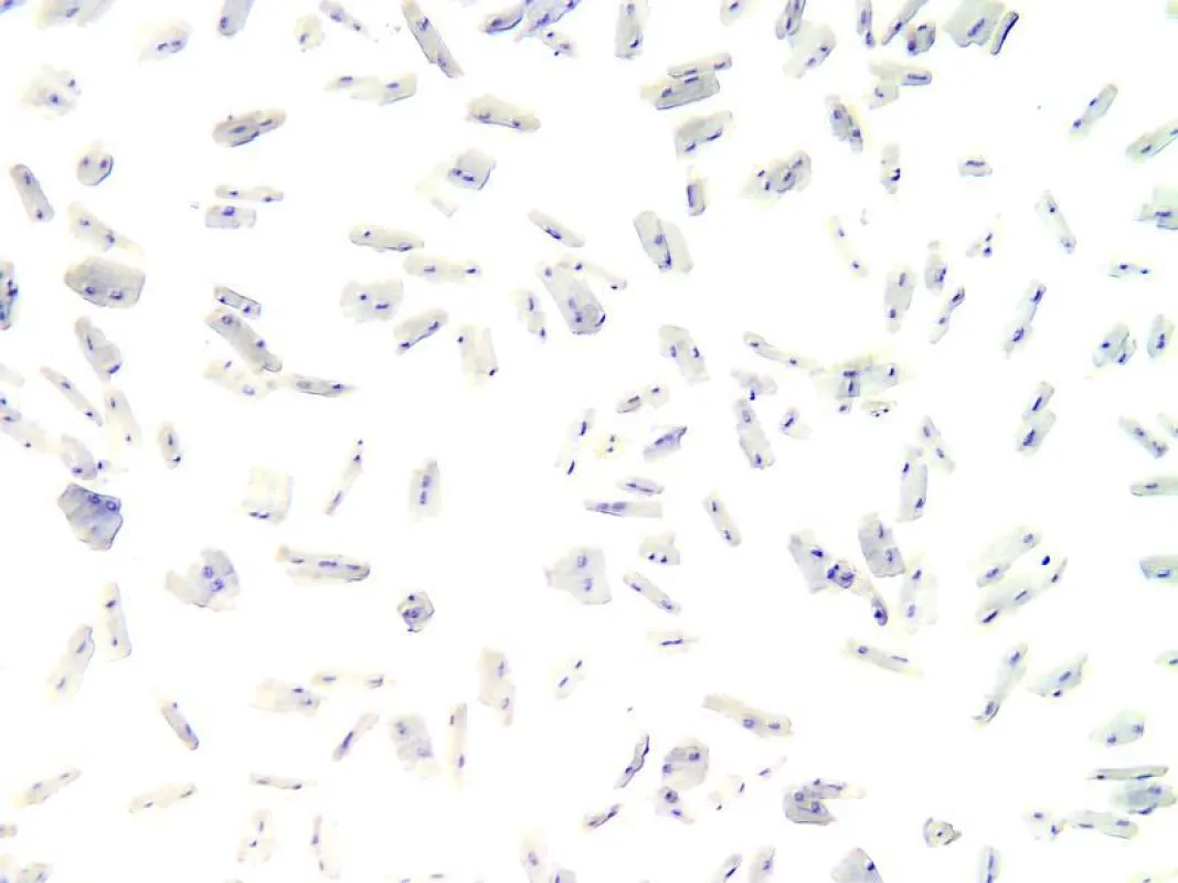 Bevor das Erbgut der Kardiomyozyten sequenziert werden kann, müssen die Zellen vereinzelt werden.  (Foto: Gotthardt Lab, MDC)