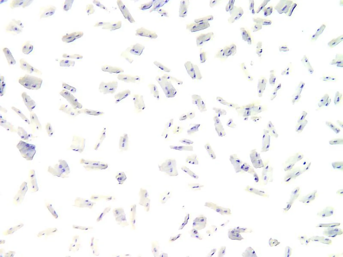 Bevor das Erbgut der Kardiomyozyten sequenziert werden kann, müssen die Zellen vereinzelt werden.  (Foto: Gotthardt Lab, MDC)