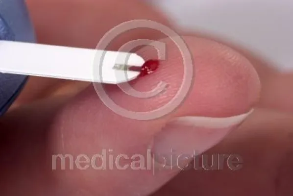 Bild: Das piekst, piekst, piekst ... medicalpicture auf der picturehouse in Hamburg