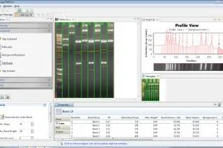 Bio-Imaging Plattform reduziert Aufwand zur Entwicklung von Software in Medizin und Forschung. Bild: Bio-Imaging Plattform reduziert Aufwand zur Entwicklung von Software in Medizin und Forschung.