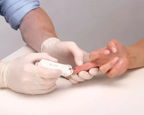 Bild: Ab Februar neuer HIV-Schnelltest Simplitude™ Pro HIV in Europa erhältlich