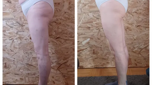 Bild: Umadum Gsund – Studio by Selina: Straffere Haut durch Lymphdrainage