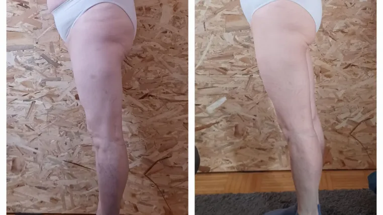 Bild: Umadum Gsund – Studio by Selina: Straffere Haut durch Lymphdrainage