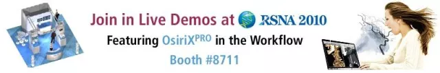 Bild: aycan präsentiert PACS Lösungen auf der RSNA 2010