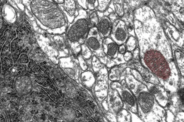 Bild: Warum ein Diabetesmedikament bei Parkinson helfen könnte