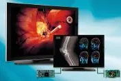 Bild: 30-Zoll Diagnostik Farb-Bildschirm