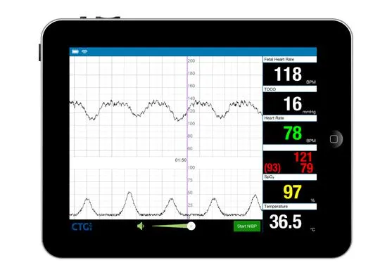 Bild: CTGi von iSimulate: Weltweit erste Kardiotokografie-Simulation auf iPad-Basis