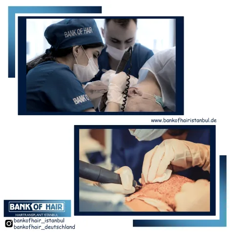 Bild: HAARTRANSPLANTATION IN ISTANBUL