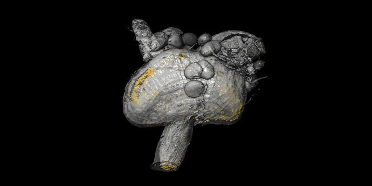 3D-Modell des Proventrikulus, eines speziellen Organs der Tsetsefliege: Die Verteilung der Trypanosomen ist anhand der fluoreszierenden Zellkerne in Gelb visualisiert.  ((Bild: Lehrstuhl Zoologie I/eL