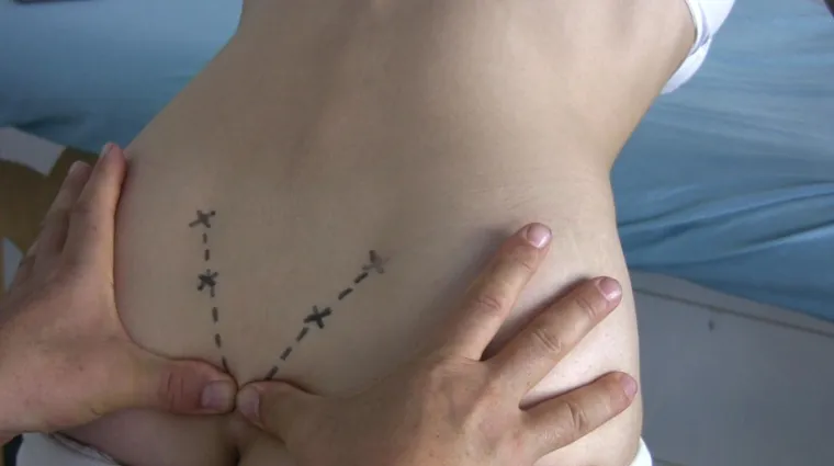 Bild: Die Wirbeltherapie nach DORN eine geniale Methode — unverstanden und nicht gebührend anerkannt