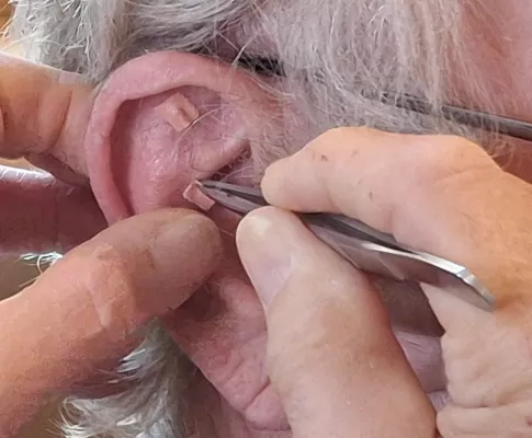 Bild: Übergewicht und Adipositas: Ein Blick durch die Linse der Traditionellen Chinesischen Medizin