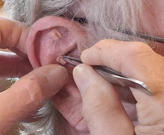 Übergewicht und Adipositas: Ein Blick durch die Linse der Traditionellen Chinesischen Medizin Bild: Übergewicht und Adipositas: Ein Blick durch die Linse der Traditionellen Chinesischen Medizin