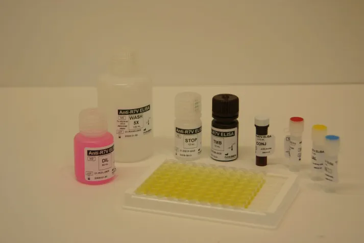 Bild: Neuer ELISA-Test bestimmt die Nicht-Entwicklung von AIDS