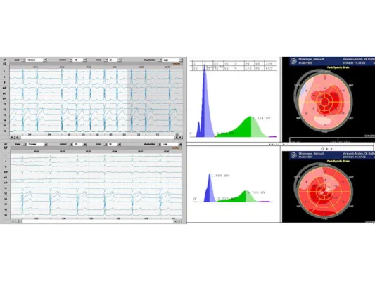 Bild: Patientengeschichte - Nützt die Stoffwechseltherapie auch in Sachen Herz?