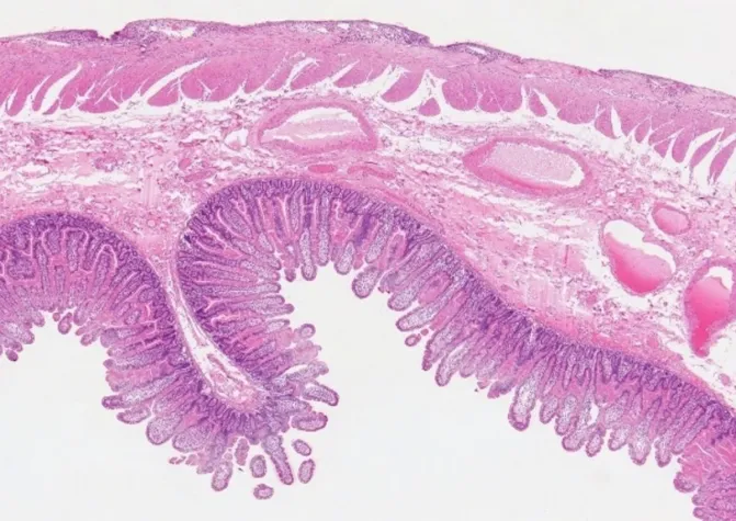 Darmsanierung - der Gesundheits-Booster Bild: Darmsanierung - der Gesundheits-Booster