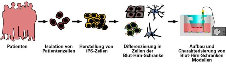 Neues Verbundprojekt erforscht die neurodegenerative Erkrankung Morbus Alzheimer Bild: Neues Verbundprojekt erforscht die neurodegenerative Erkrankung Morbus Alzheimer