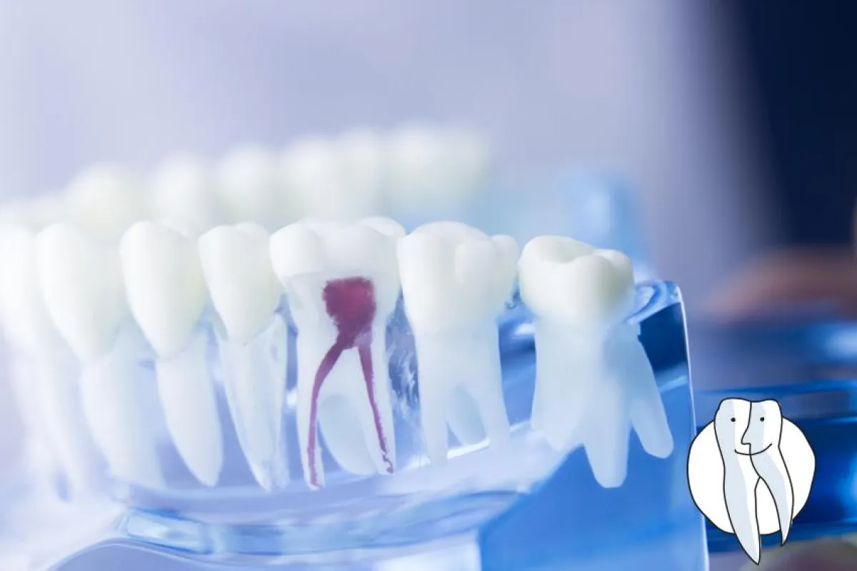 Wurzelbehandlung Fotolia©edwardolive