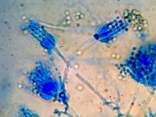 Bild: Energieberater aus Aschau sagt Schimmel- pilzen in der Wohnung den Kampf an